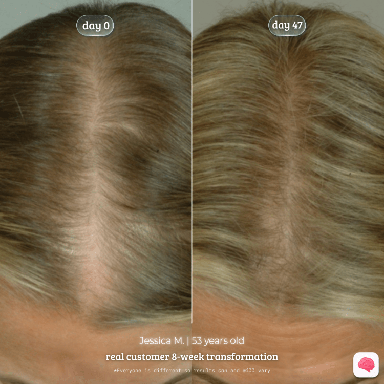 Before and after hair transformation of Jessica M. over an 8-week period.